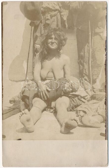 Félmeztelen cigány nő kisbabával / Half-naked gypsy woman with her child. photo (EK)