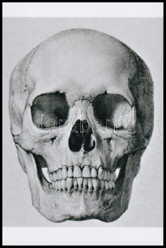 Koponyák, az aktkompozíció eredetileg fotórealisztikus stílusban készült olajfestmény, a másik felvétel orvosi könyv illusztrációja, 2 db mai fotónagyítás, 21x15 cm és 15x10 cm - Image 2